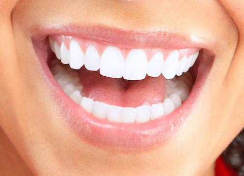 cosmetic dentist in raleigh nc