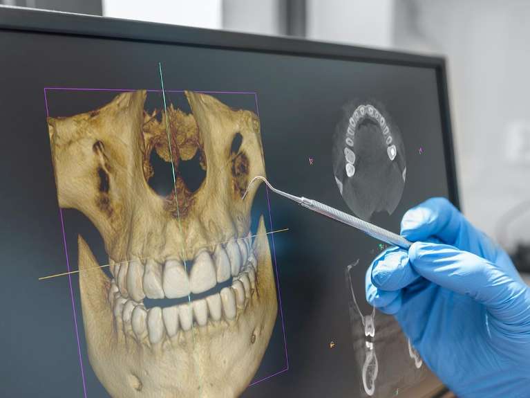 3-D cone beam technology at dentist in raleigh nc