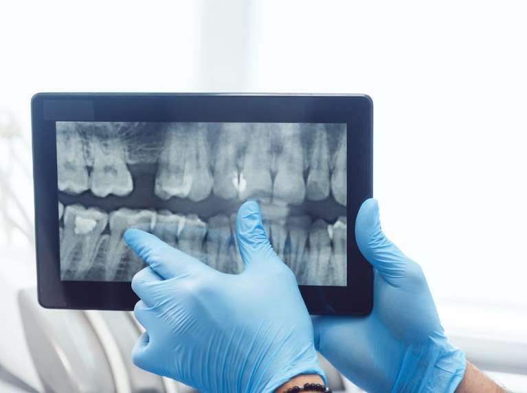 digital x-rays for dentist in raleigh nc